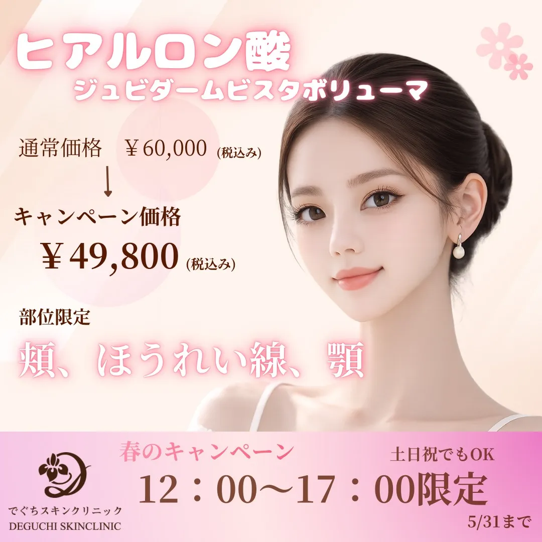 ヒアルロン酸ジュビダームビスタボリューマ