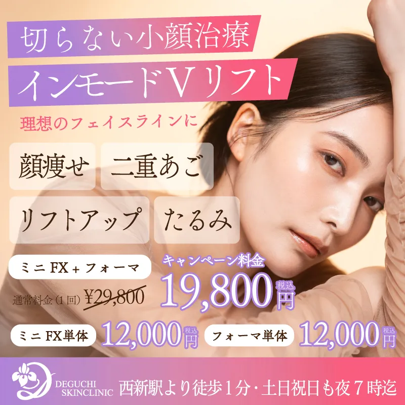 インモードVリフト