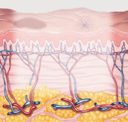IPLの光がメラニン色素やヘモグロビンに吸収