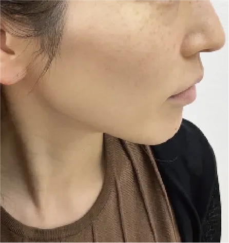 治療前
