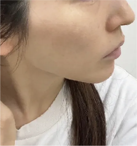 治療後
